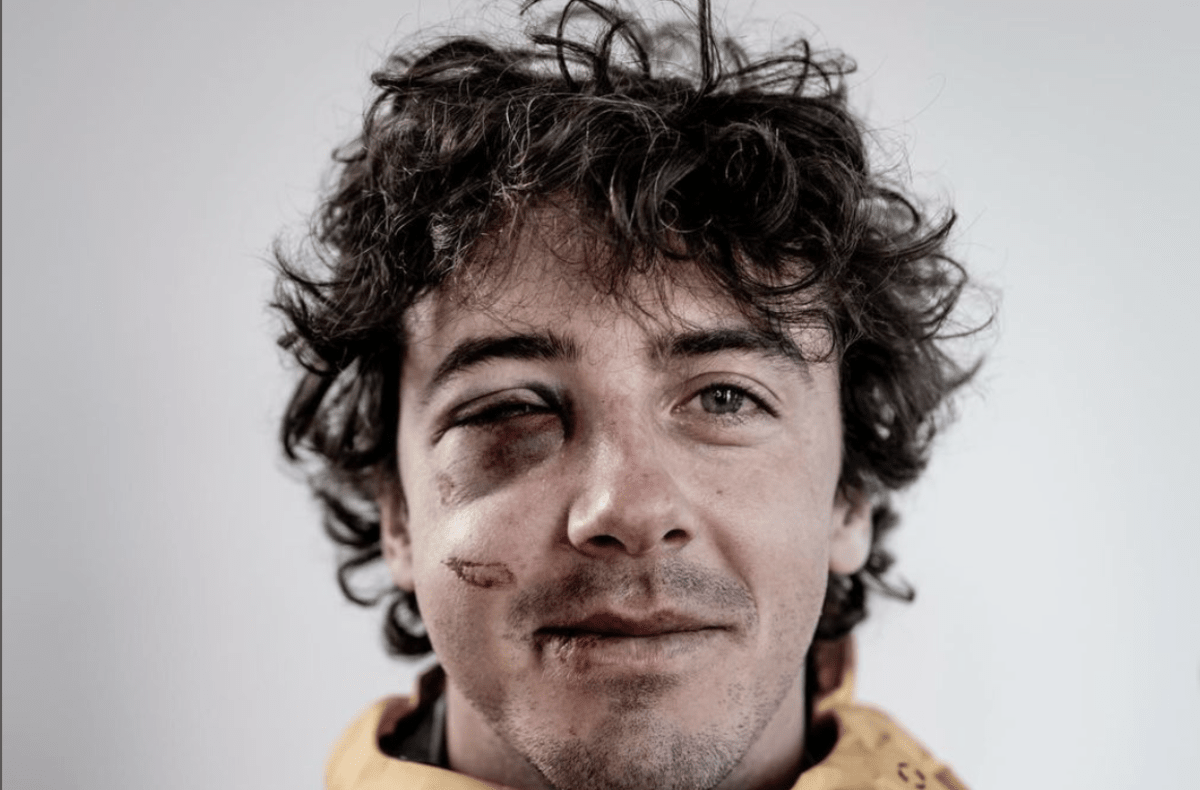 Mark McMorris Suffers From Severe Face Injury - Snowboarder